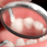 What are the symptoms of cavities?